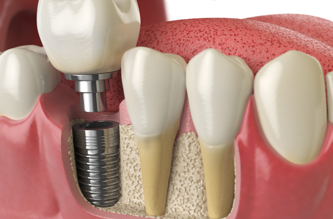 Stomatologist and her assistant treating woman for dental cavity